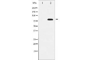 Western blot analysis of Rel expression in MDA-MB-435 whole cell lysates,The lane on the left is treated with the antigen-specific peptide. (c-Rel anticorps  (Internal Region))