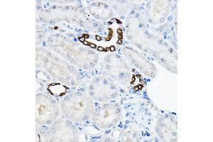 Immunohistochemistry of paraffin-embedded rat kidney using EVA Rabbit pAb  at dilution of 1:100 (40x lens). (TMEM166 anticorps)