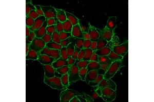 Immunofluorescent staining of MCF-7 cells. (EpCAM anticorps  (Extracellular Domain))