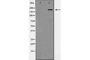 Western blot analysis of Integrin β4 expression in HepG2 cells. (Integrin beta 4 anticorps  (C-Term))