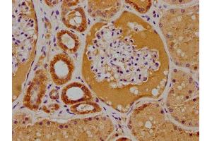 IHC image of ABIN7156191 diluted at 1:100 and staining in paraffin-embedded human kidney tissue performed on a Leica BondTM system. (PTK7 anticorps  (AA 772-1070))