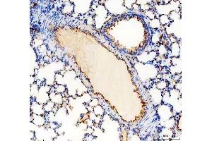 IHC analysis of CD31/Pecam1 using anti-CD31/Pecam1 antibody (ABIN7601662). (CD31 anticorps  (AA 41-258))