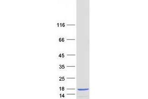 Validation with Western Blot
