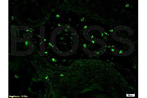 Immunofluorescence (IF) image for anti-CD8 (CD8) (AA 51-150) antibody (ABIN671391)