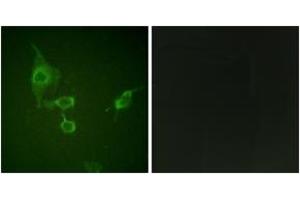 Immunofluorescence analysis of HepG2 cells, using HCK (Ab-410) Antibody. (HCK anticorps  (AA 381-430))