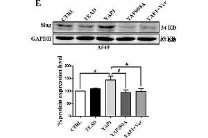 Slug is regulated by the co-transcriptional complex YAP1/TEAD in the EMT program of A549 cells. (GAPDH anticorps)