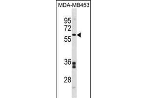 FMO5 Antibody (C-term) (ABIN1881348 and ABIN2839104) western blot analysis in MDA-M cell line lysates (35 μg/lane). (FMO5 anticorps  (C-Term))