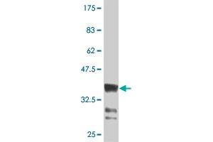 Western Blot detection against Immunogen (36. (HOXB9 anticorps  (AA 65-163))