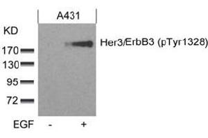 Image no. 2 for anti-Receptor Tyrosine-Protein Kinase ErbB-3 (ERBB3) (pTyr1328) antibody (ABIN319273) (ERBB3 anticorps  (pTyr1328))