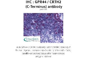 Image no. 1 for anti-Prostaglandin D2 Receptor 2 (PTGDR2) (C-Term), (Cytoplasmic Domain) antibody (ABIN1735100)