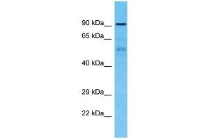 Host:  Rabbit  Target Name:  ZNF658B  Sample Type:  Breast Tumor lysates  Antibody Dilution:  1. (ZNF658B anticorps  (Middle Region))