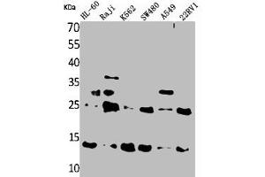 Western Blot analysis of HL-60 Raji K562 SW480 A549 22RV-1 cells using TRP14 Polyclonal Antibody (TXNDC17 anticorps  (Internal Region))
