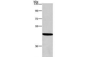 Western Blot analysis of 293T cell using HDAC8 Polyclonal Antibody at dilution of 1:950 (HDAC8 anticorps)