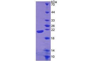 Image no. 2 for Interleukin 1, beta (IL1B) (AA 117-269) (Active) protein (His tag) (ABIN6239756)