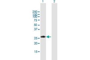 Western Blot analysis of RPIA expression in transfected 293T cell line by RPIA MaxPab polyclonal antibody. (Ribose 5-Phosphate Isomerase A (RPIA) (AA 1-237) anticorps)