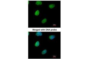 ICC/IF Image Immunofluorescence analysis of paraformaldehyde-fixed HeLa, using ITPK1, antibody at 1:200 dilution.