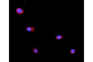IF analysis of GLB1 using anti-GLB1 antibody (ABIN7599649). (GLB1 anticorps  (AA 103-646))