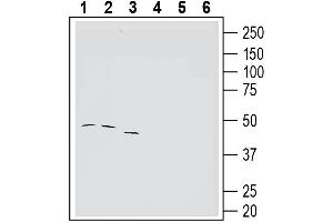 Western blot analysis of human K562 erythroleukemia cell line lysate (lanes 1 and 4), human Jurkat T-cell leukemia cell line lysate (lanes 2 and 5) and human LNCaP prostate adenocarcinoma cell line lysate (lanes 3 and 6):1-3. (Tetraspanin 3 anticorps  (Extracellular))