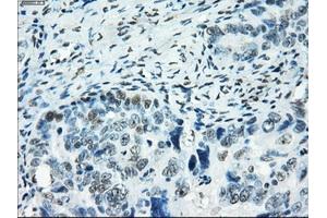 Immunohistochemical staining of paraffin-embedded colon tissue using anti-SATB1mouse monoclonal antibody. (SATB1 anticorps)