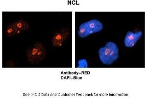 Sample Type :  Human brain stem cells  Primary Antibody Dilution :  1:500  Secondary Antibody :  Goat anti-rabbit Alexa-Fluor 594  Secondary Antibody Dilution :  1:1000  Color/Signal Descriptions :  NCL: Red DAPI:Blue  Gene Name :  NCL  Submitted by :  Dr.