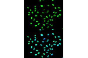 Immunofluorescence analysis of MCF-7 cells using HNRNPK antibody (ABIN5970850).