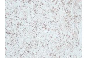 Image no. 1 for anti-gamma-Interferon-Induced Monokine (CXCL9) antibody (ABIN465878) (CXCL9 anticorps)