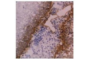 Cryostat section of human tonsil stained with anti-CD104 antibody ABIN118872 (Integrin beta 4 anticorps)