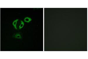 Immunofluorescence analysis of A549cells, using TACC3 antibody. (TACC3 anticorps  (C-Term))