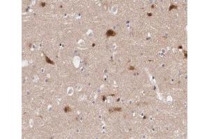 ABIN6266460 at 1/200 staining human Cerebellum tissue sections by IHC-P. (PAK3 anticorps  (pSer154))