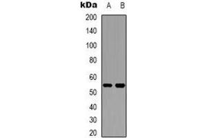 Western blot analysis of Cytochrome P450 2W1 expression in Hela (A), HepG2 (B) whole cell lysates.