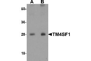 Western blot analysis of TM4SF1 in human lung tissue lysate with TM4SF1 antibody at (A) 0. (TM4SF1 anticorps  (N-Term))