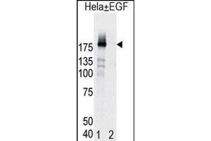 Western blot analysis of EGFR (arrow) in Hela cell lysates, either induced (Lane 1) or noninduced with EGF (Lane 2).