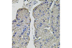 Immunohistochemistry of paraffin-embedded human stomach using CA9 antibody (ABIN6292666) at dilution of 1:100 (40x lens). (CA9 anticorps)