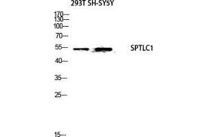 Western Blot (WB) analysis of 293T SH-SY5Y lysis using SPTLC1 antibody.