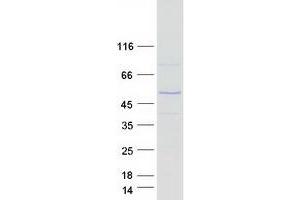 Validation with Western Blot