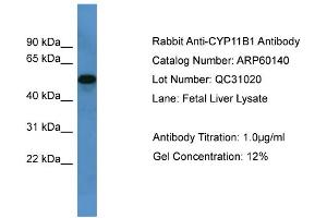 WB Suggested Anti-CYP11B1  Antibody Titration: 0. (CYP11B1 anticorps  (C-Term))