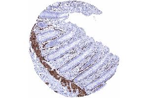 Appendix mucosa Intense caldesmon h positivity of intestinal subepithelial myofibroblasts ISEMFs and of the muscularis mucosae Caldesmon h immunohistochemistry
