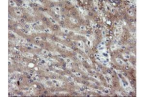 Image no. 1 for anti-Phosphoinositide-3-Kinase, Catalytic, gamma Polypeptide (PIK3CG) antibody (ABIN1500203)