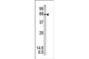 Image no. 1 for anti-Signal Transducer and Activator of Transcription 1, 91kDa (STAT1) (pSer727) antibody (ABIN358231) (STAT1 anticorps  (pSer727))