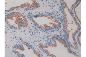 IHC-P analysis of Human Prostate Gland Tissue, with DAB staining. (DPP4 anticorps  (AA 484-728))