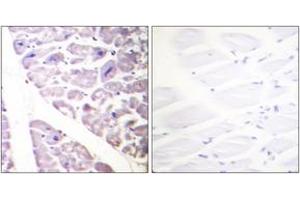 Immunohistochemistry analysis of paraffin-embedded human heart, using IKK-alpha (Phospho-Ser176) /IKK-beta (Phospho-Ser177) Antibody.