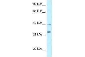 Western Blot showing TNFRSF14 antibody used at a concentration of 1 ug/ml against NCI-H226 Cell Lysate