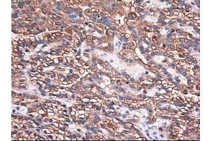 Image no. 1 for anti-Carboxypeptidase A1 (Pancreatic) (CPA1) (AA 1-419) antibody (ABIN1490771) (CPA1 anticorps  (AA 1-419))