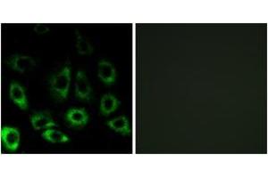 Immunofluorescence (IF) image for anti-Membrane-Bound Transcription Factor Peptidase, Site 2 (MBTPS2) (AA 301-350) antibody (ABIN2890405) (MBTPS2 anticorps  (AA 301-350))