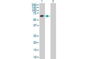 Western Blot analysis of LRIT3 expression in transfected 293T cell line by LRIT3 MaxPab polyclonal antibody. (LRIT3 anticorps  (AA 1-552))