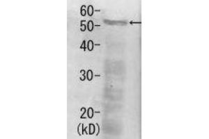 Western Blotting (WB) image for anti-Proteasome (Prosome, Macropain) 26S Subunit, Non-ATPase, 12 (PSMD12) antibody (ABIN2452114) (PSMD12 anticorps)