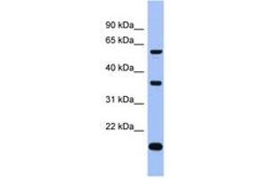 Image no. 1 for anti-La Ribonucleoprotein Domain Family, Member 6 (LARP6) (C-Term) antibody (ABIN6743023) (LARP6 anticorps  (C-Term))