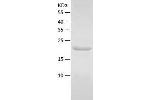 Western Blotting (WB) image for Ubiquitin-Conjugating Enzyme E2 Variant 1 (UBE2V1) (AA 2-170) protein (His tag) (ABIN7125602) (UBE2V1 Protein (AA 2-170) (His tag))