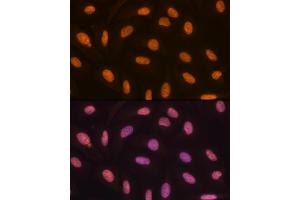 Immunofluorescence analysis of U-2 OS cells using KDM4B/JMJD2B Rabbit mAb (ABIN7268329) at dilution of 1:100 (40x lens). (KDM4B anticorps)