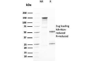 SDS-PAGE Analysis Purified CD25 Mouse Monoclonal Antibody (IL2RA/2394). (CD25 anticorps  (AA 42-183))